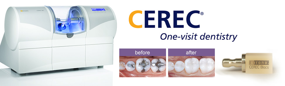 What is a CEREC Crown and What is the Process?