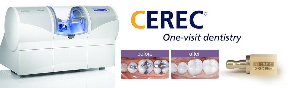 cerec crowns