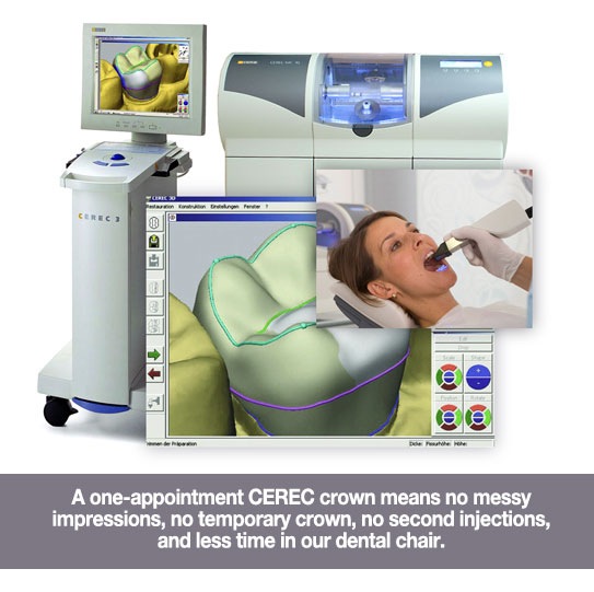 same day cerec crowns