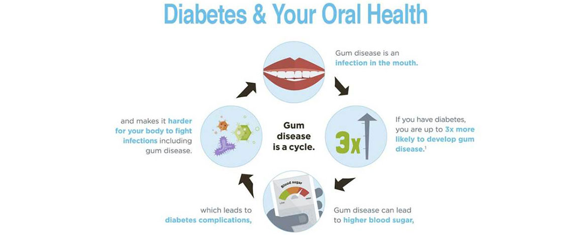 Diabetes and oral health