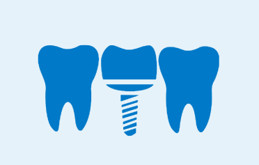 tooth-replacment-options