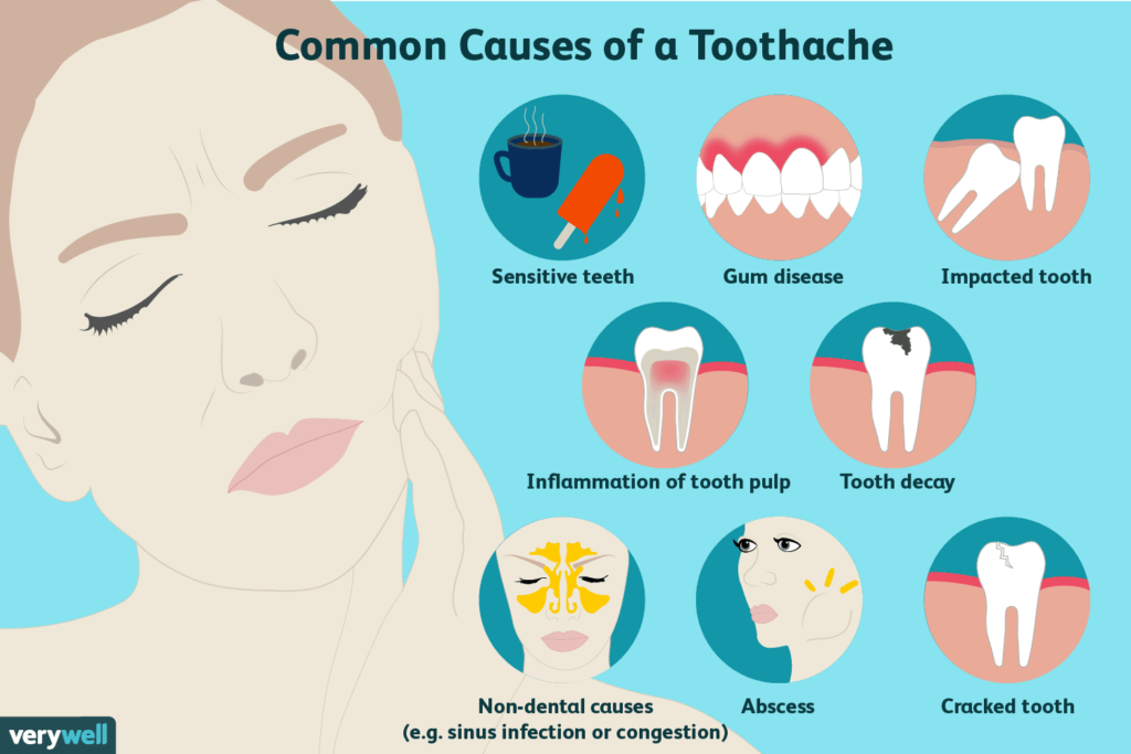 toothache-causes-1024x683.png