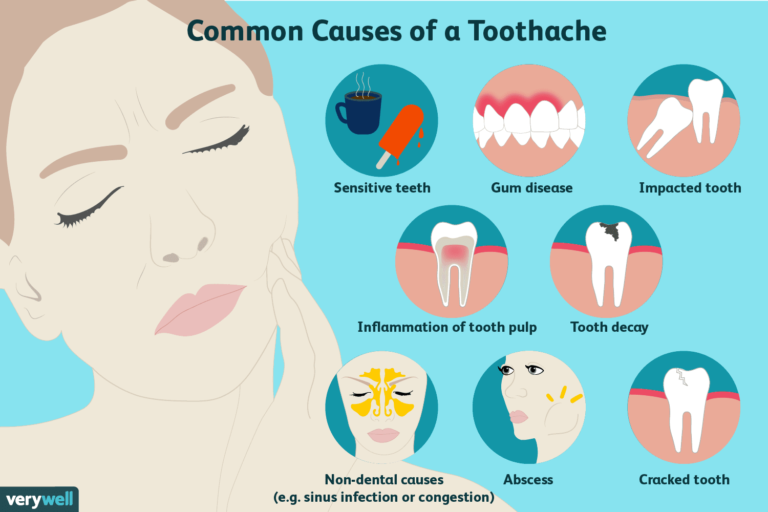 Can A Tooth Infection Cause Sinus Infection