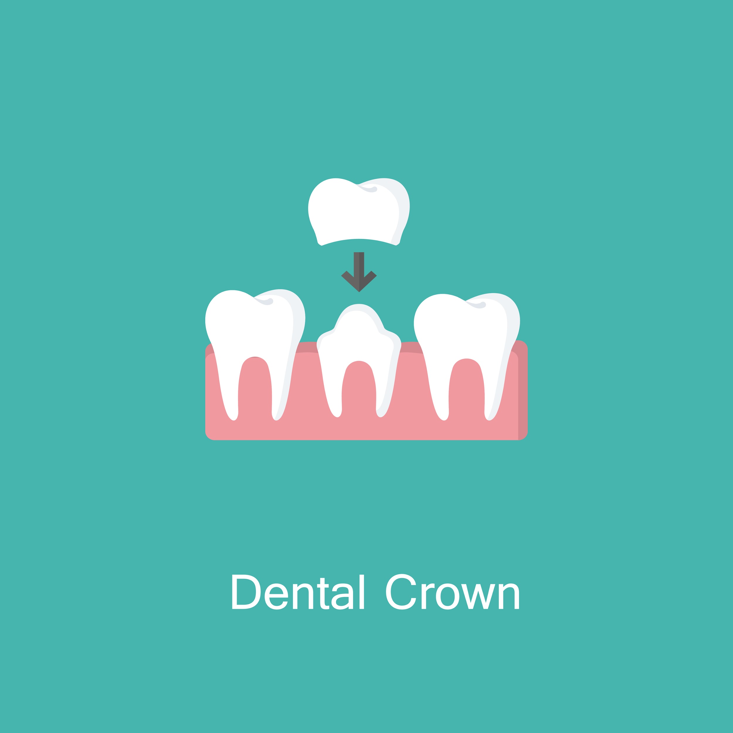 dental-crown