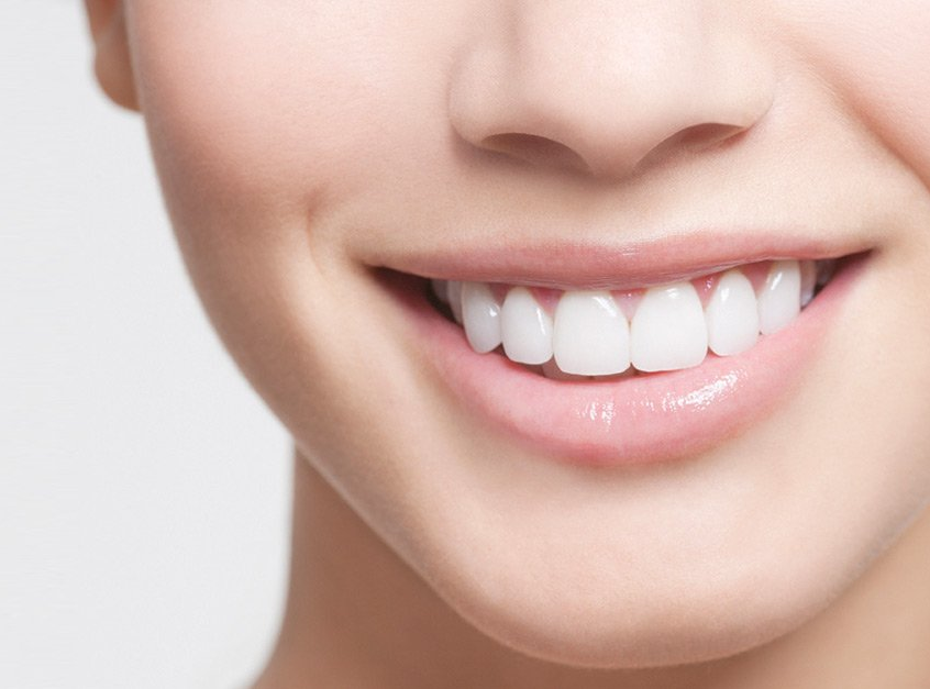 What Exactly is a Smile Makeover?