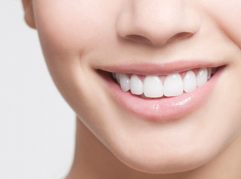 Why You Should Get a Smile Makeover