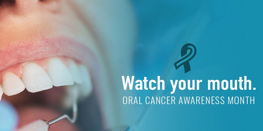 oral-cancer-screening