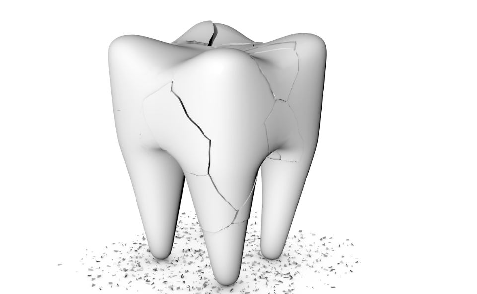 prevent-cracked-teeth